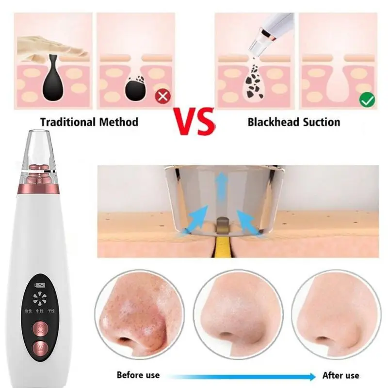 LumiGlow™ Advanced Facial Blackhead Cleanser