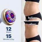 ProSculpt ᵀᴹ & Cupping Massager