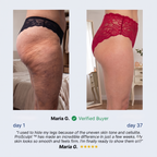 ProSculpt ᵀᴹ & Cupping Massager